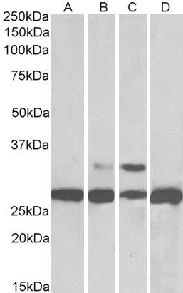 Goat Anti-PGAM1 / PGAM2 / PGAM4 Antibody