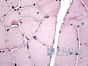 Goat Anti-PGC-1beta / PERC Antibody