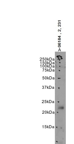 Goat Anti-PHLDA2 / IPL Antibody