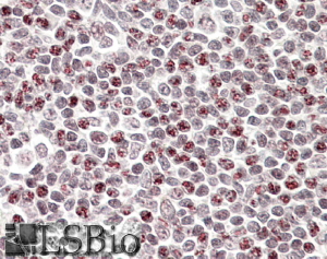 Goat Anti-Phorbolin 1 / APOBEC3A Antibody