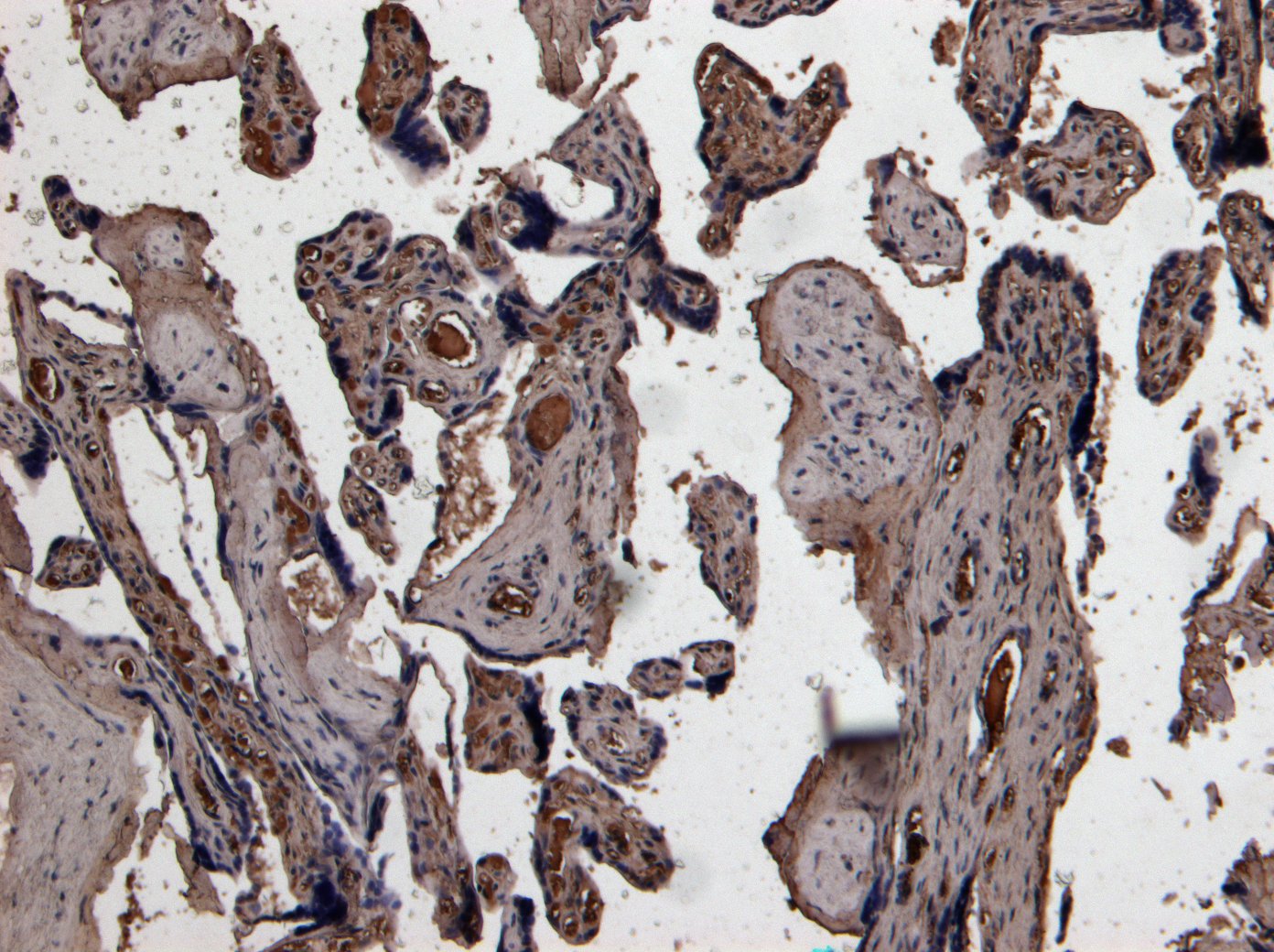 Goat Anti-Plasminogen Activator / PLAU Antibody