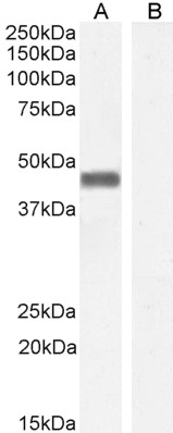 Goat Anti-Pleckstrin Antibody
