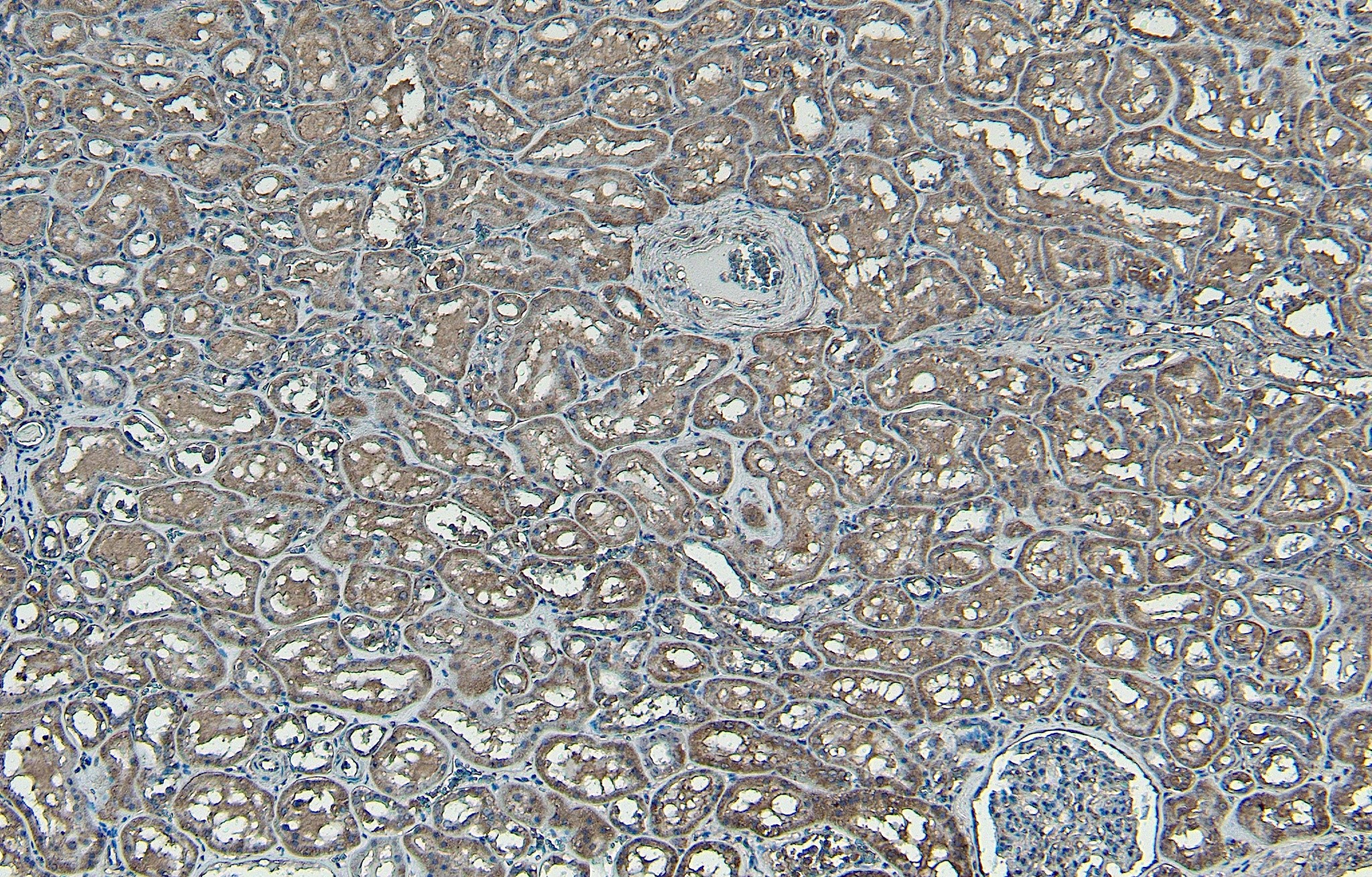 Goat Anti-Pnpla3 / Adiponutrin (mouse) Antibody