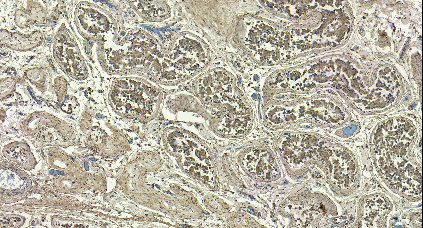 Goat Anti-PPP1R12A Antibody