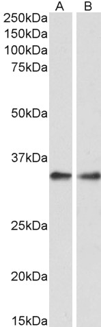 Goat Anti-PPP4C Antibody