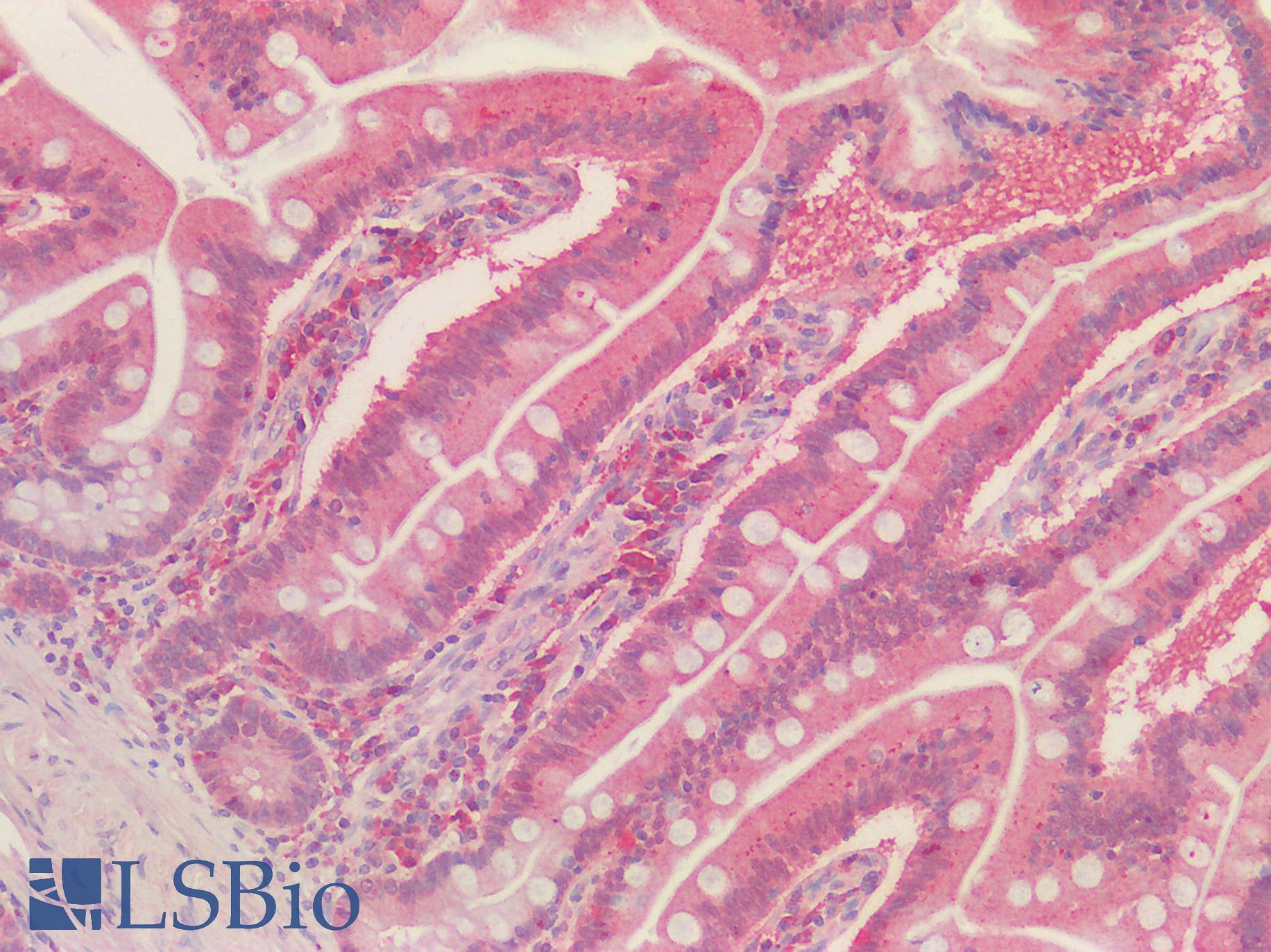 Goat Anti-PRDX1 Antibody