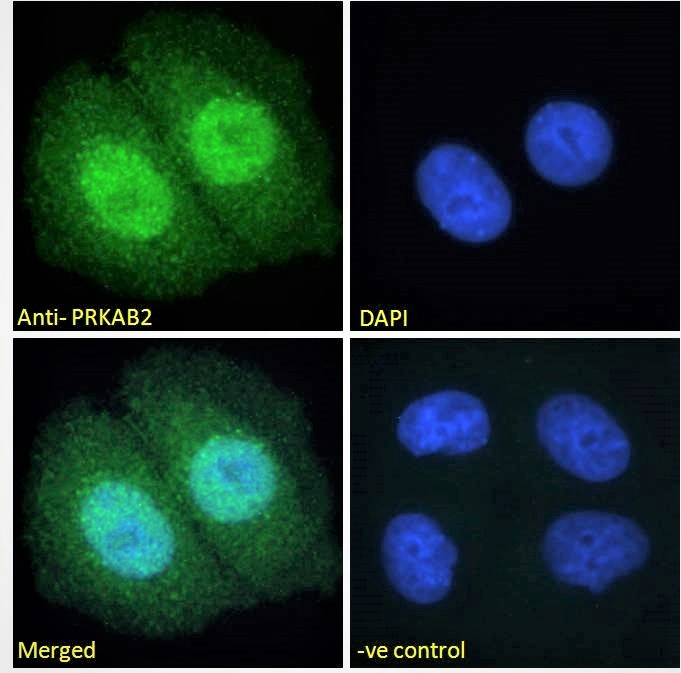Goat Anti-PRKAB2 Antibody