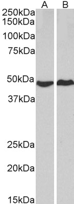Goat Anti-PRKACA Antibody