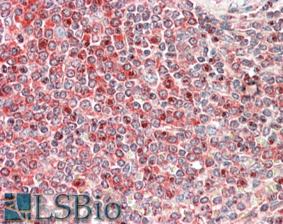 Goat Anti-PRKCB Antibody