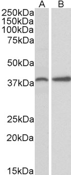 Goat Anti-PRKCDBP Antibody