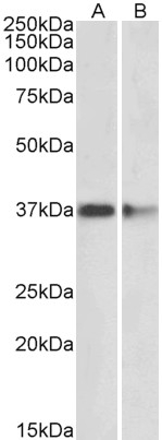 Goat Anti-PRMT2 Antibody