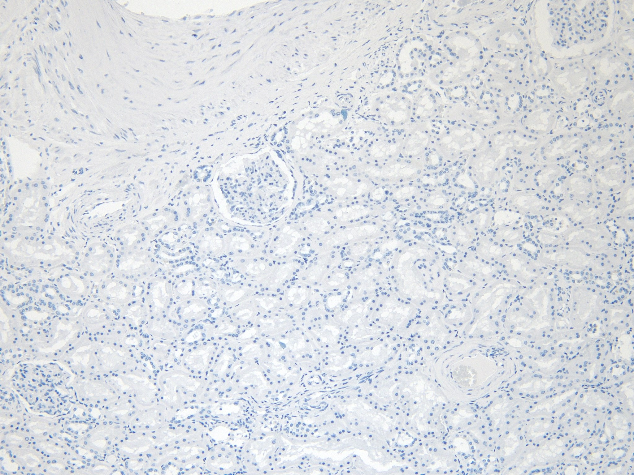 Goat Anti-PRODH Antibody