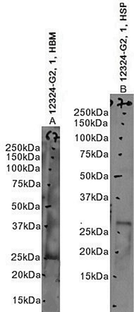 Goat Anti-proteinase 3 / myeloblastin (aa88-98) Antibody