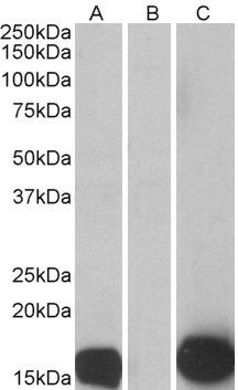 Goat Anti-Psoriasin / S100A7 Antibody
