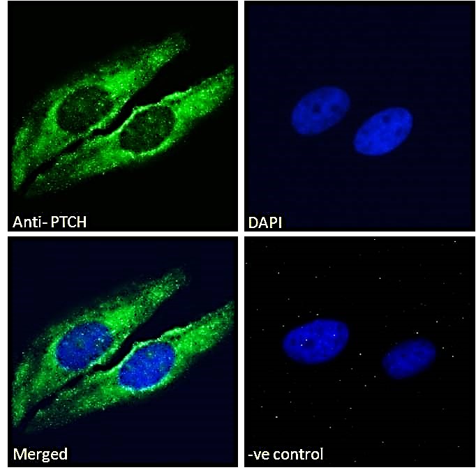 Goat Anti-PTCH (C Terminus) Antibody