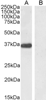 Goat Anti-PTF1A / PFT1-P48 Antibody