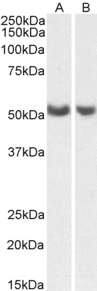 Goat Anti-PTGIS / CYP8A1 (aa248-258) Antibody