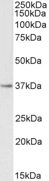 Goat Anti-PTGR1 Antibody