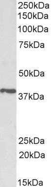 Goat Anti-PTGR2 / ZADH1 Antibody