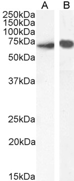 Goat Anti-PTPN6 / SHP1 (internal region) Antibody