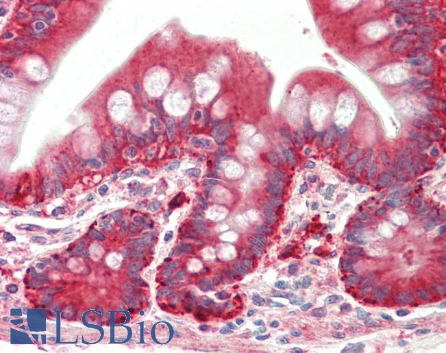 Goat Anti-PYROXD1 Antibody