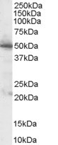 Goat Anti-Pyruvate dehydrogenase / PDHX Antibody