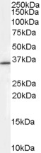 Goat Anti-Rabring 7 / BCA2 Antibody