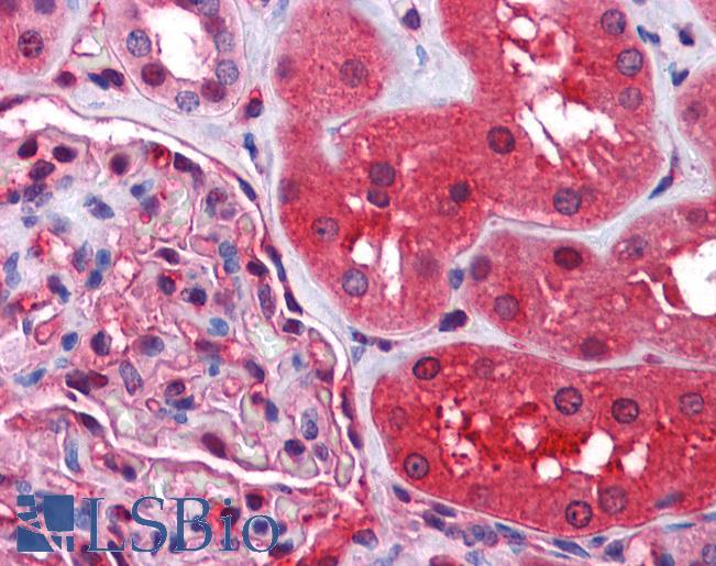 Goat Anti-Radixin Antibody