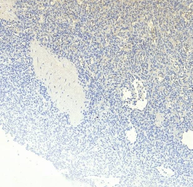 Goat Anti-RANTES Antibody