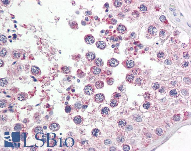 Goat Anti-RAP80 Antibody