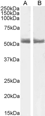 Goat Anti-RARA Antibody