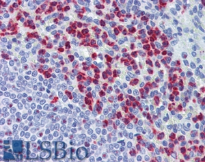 Goat Anti-RASSF2 Antibody