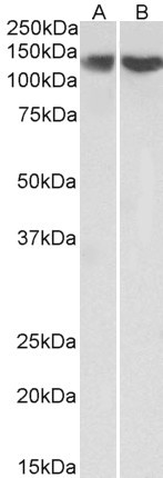 Goat Anti-RE1-silencing transcription factor Antibody