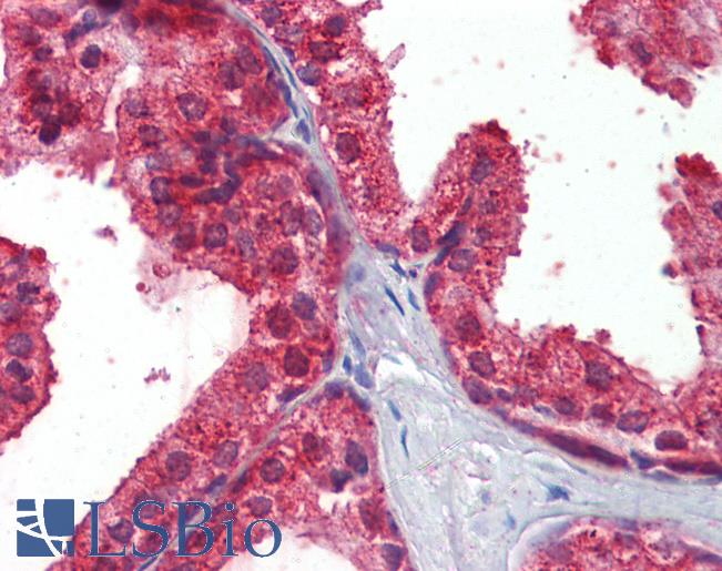 Goat Anti-Restin / CLIP1 Antibody