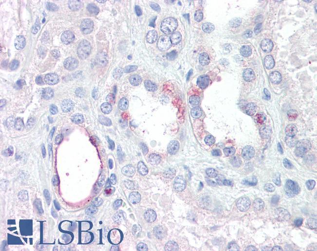 Goat Anti-RHBG Antibody