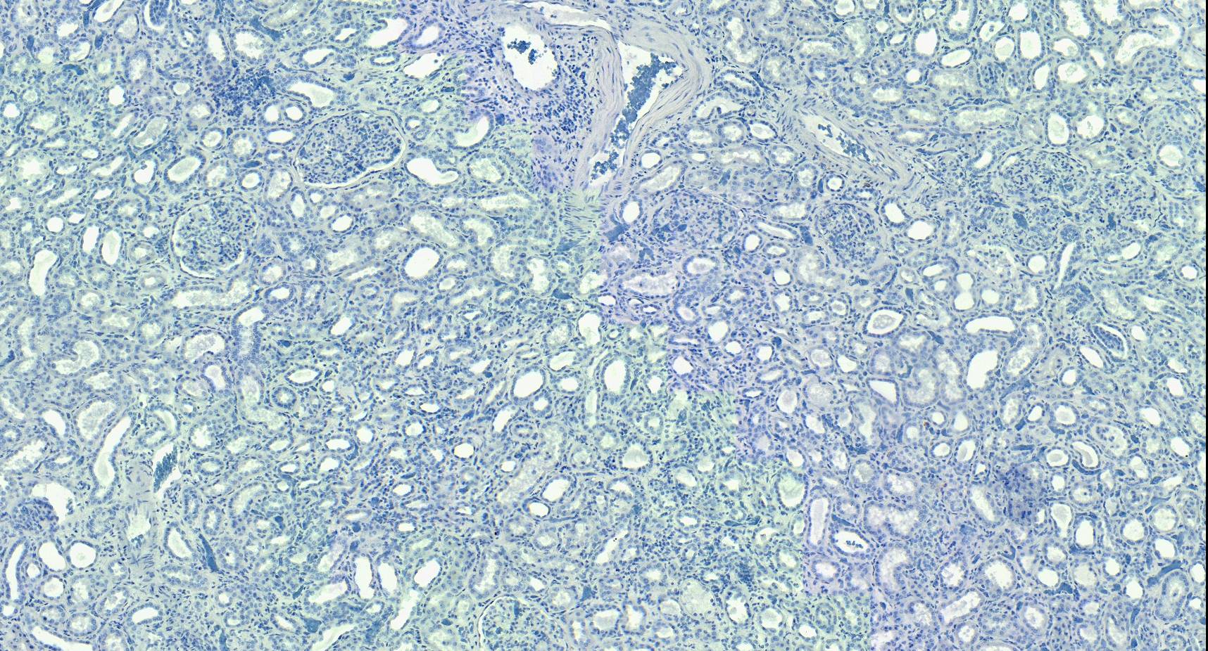 Goat Anti-ROBO1 / DUTT1 (Internal) Antibody