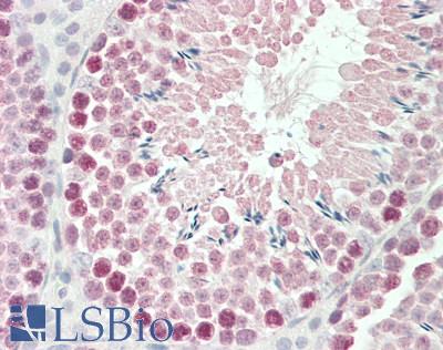 Goat Anti-Robo1 / DUTT1 (mouse) Antibody