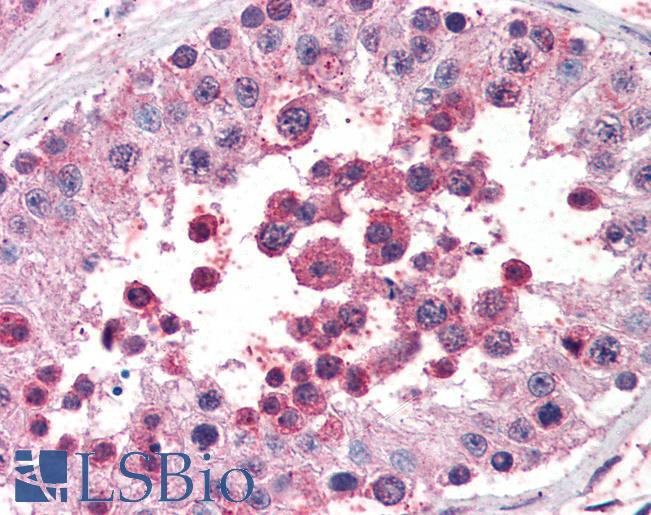 Goat Anti-ROBO2 Antibody