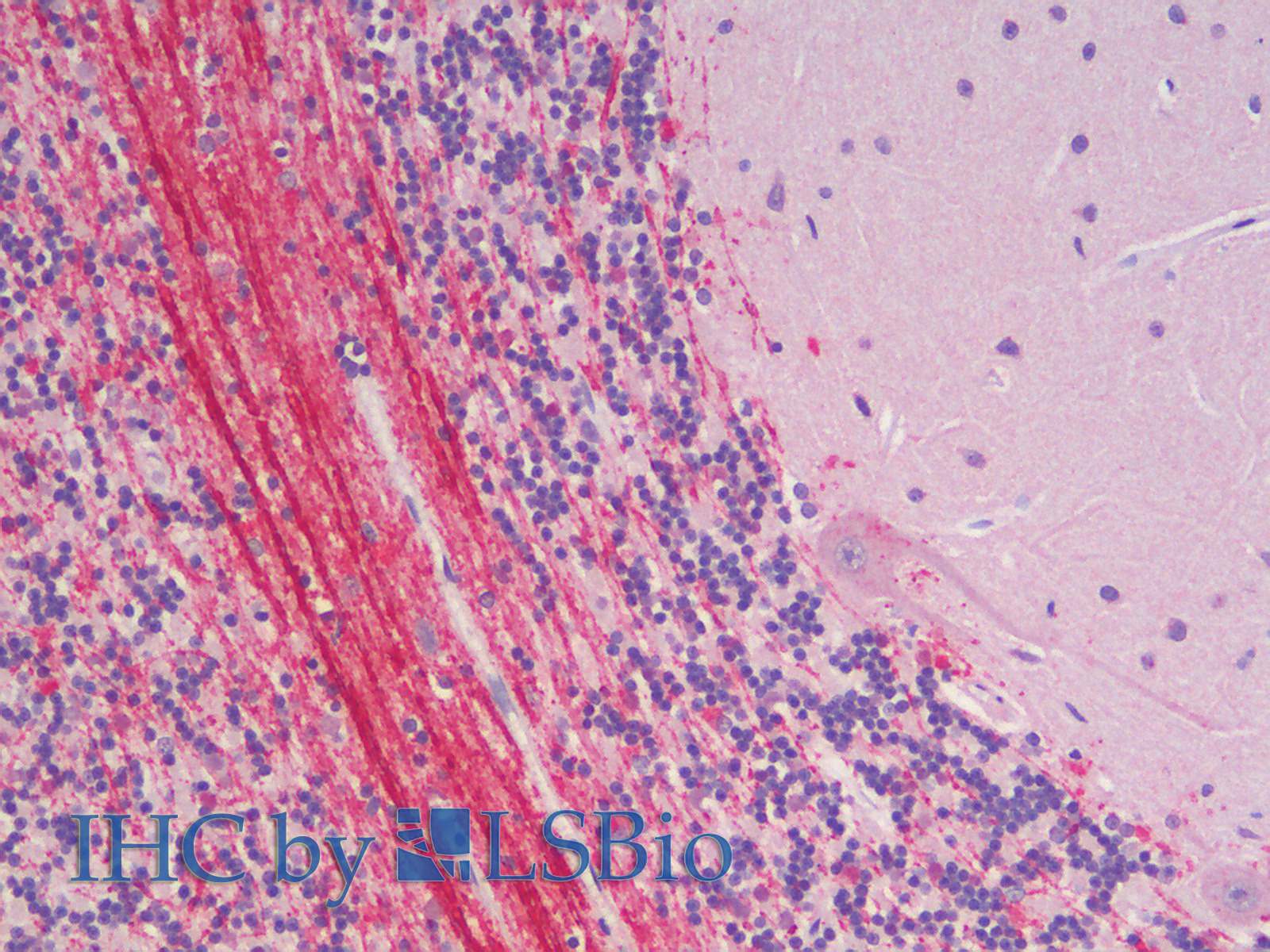 Goat Anti-Robo3.2 (mouse aa1303-1316) Antibody