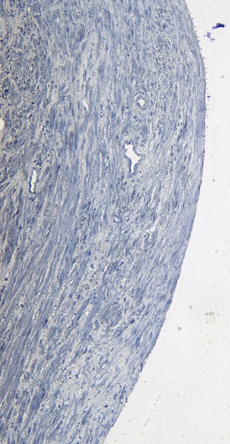 Goat Anti-ROR1 Antibody
