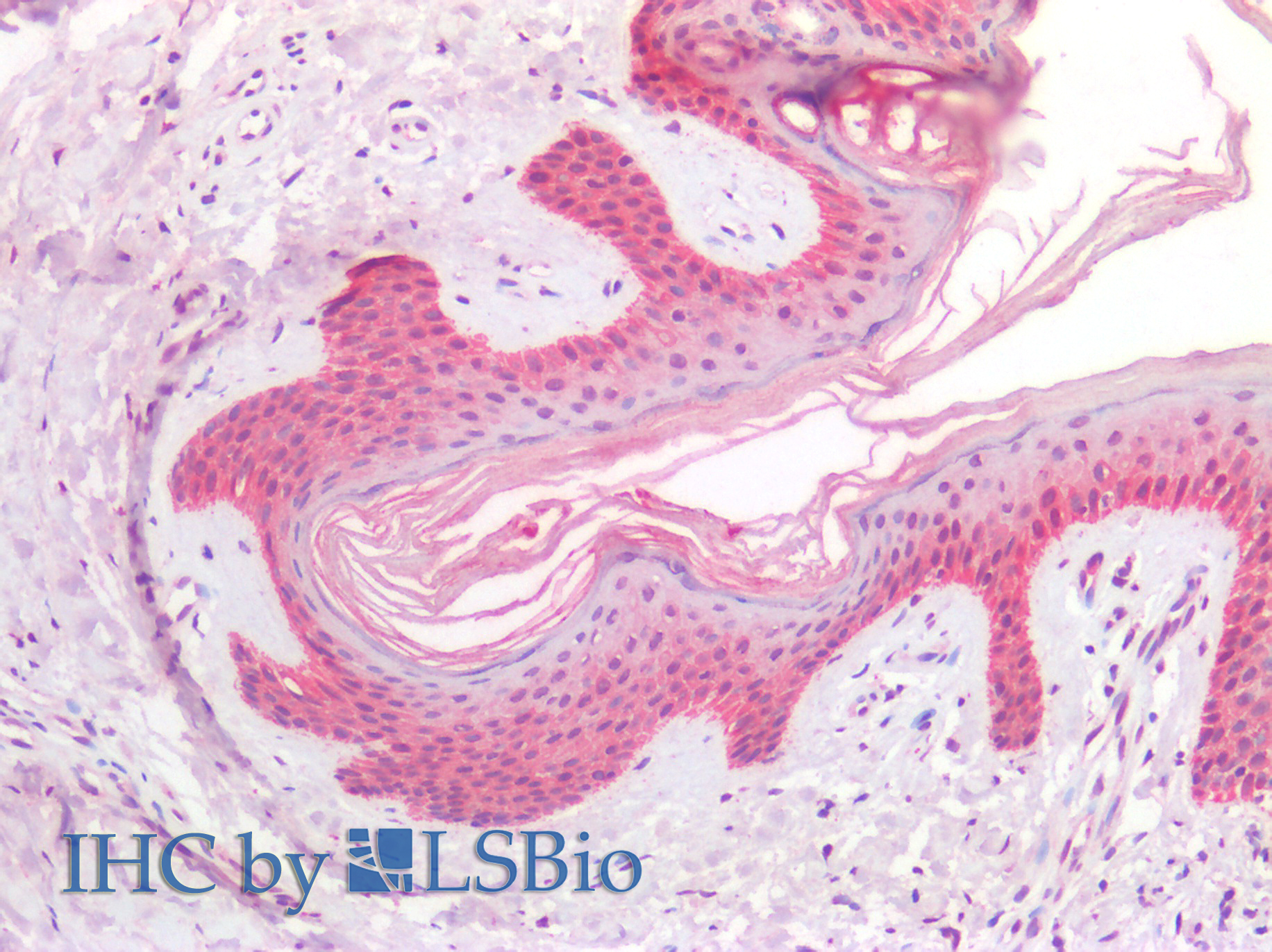 Goat Anti-RSK2 Antibody