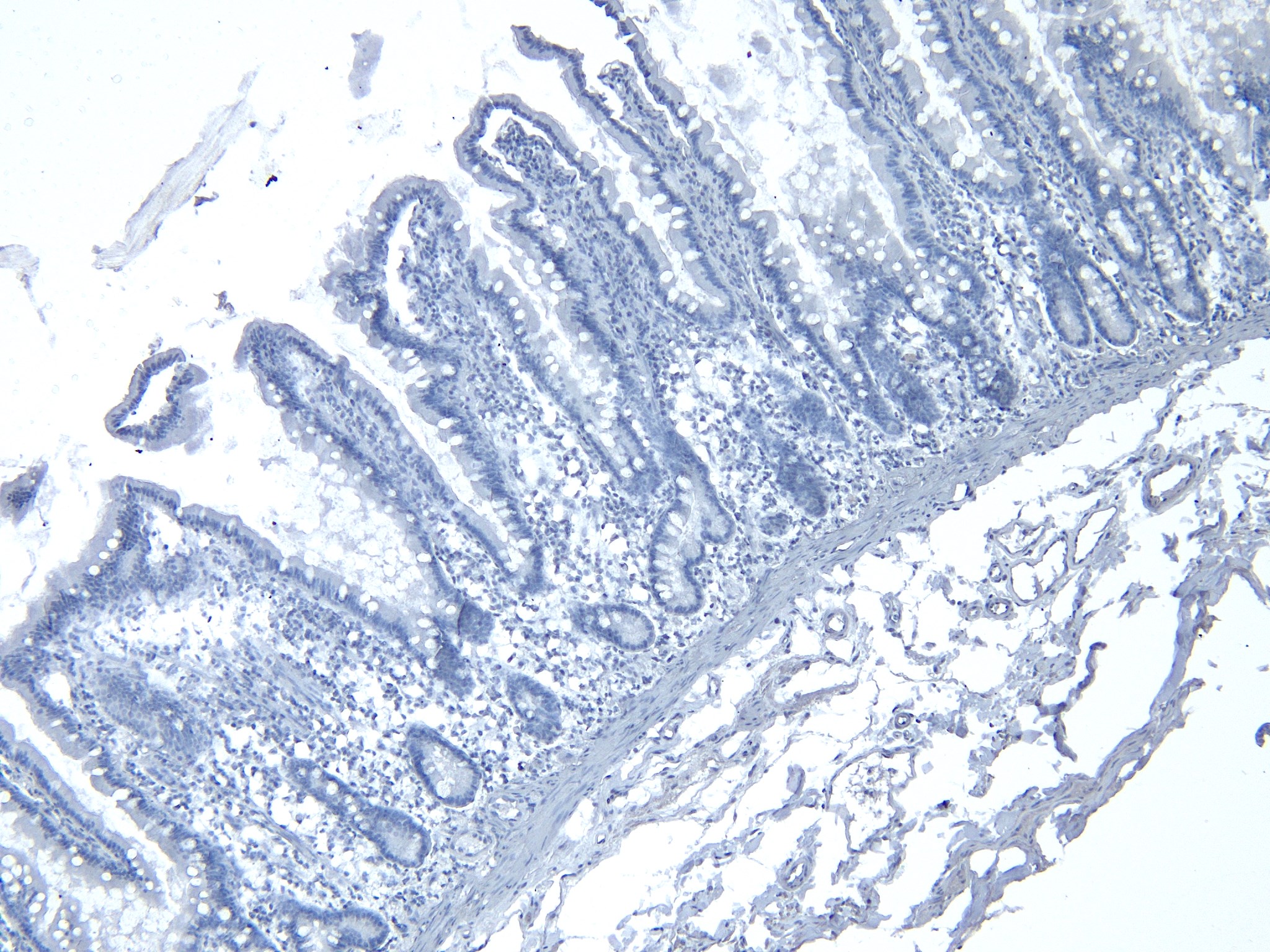 Goat Anti-RSPO3 Antibody