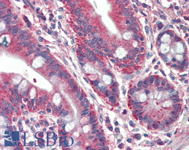 Goat Anti-RUFY1 Antibody