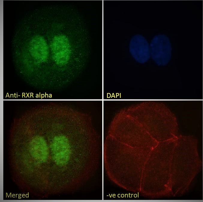 Goat Anti-RXR alpha Antibody