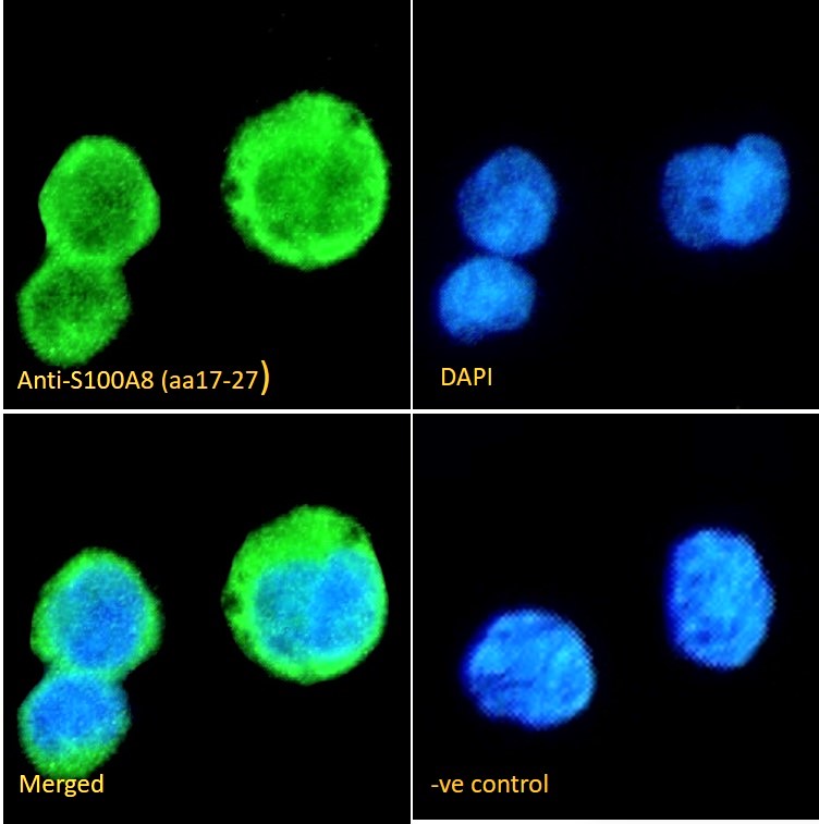 Goat Anti-S100A8 (aa17-27) Antibody