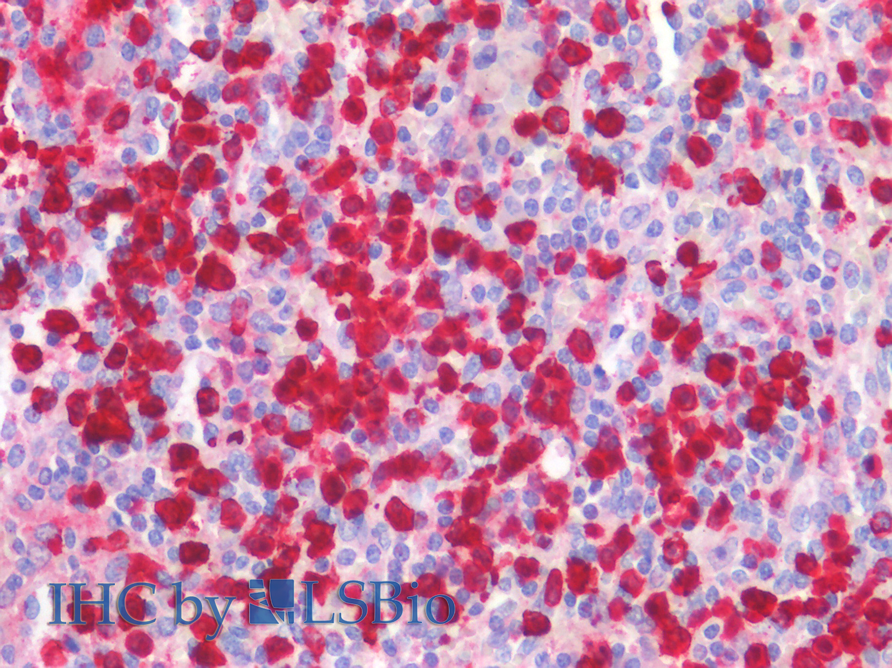 Goat Anti-S100A8 Antibody