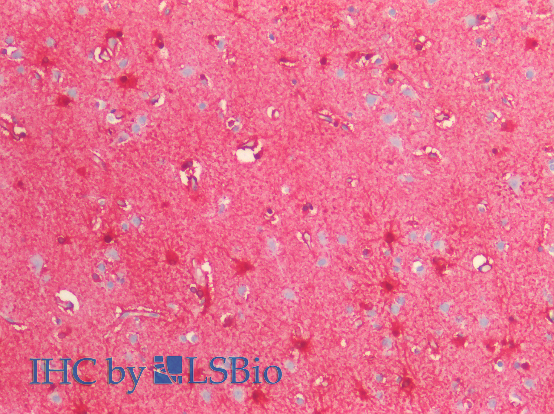 Goat Anti-S100B Antibody