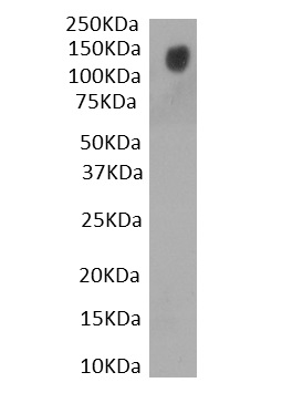 Goat Anti-SARS CoV2-Spike protein S1 Antibody