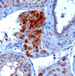 Goat Anti-SBP2 Antibody