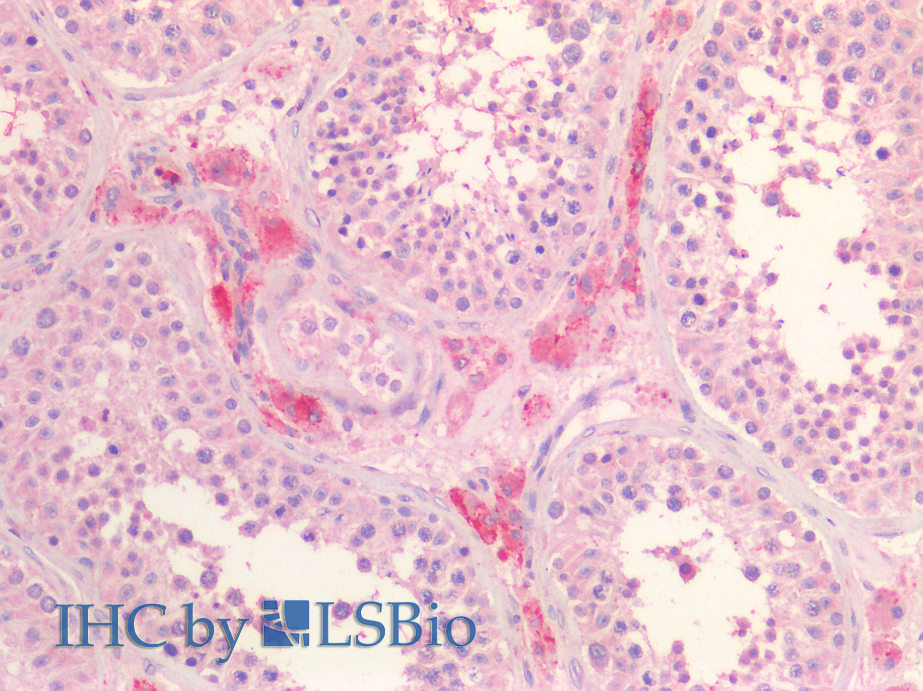 Goat Anti-SCARB1 / SR-BI (aa238-250) Antibody